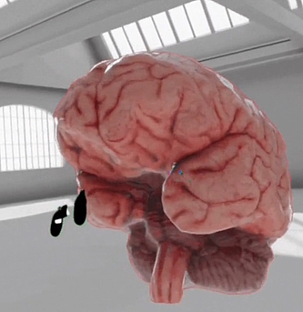 3D Hirnmodell in VR im Multiuser-Modus