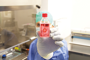 Ein Labormitarbeiter hält ein Fläschen mit einem aufbereiteten Transplantat in der Hand
