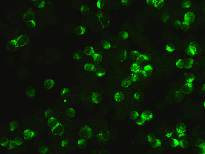 Unterm Mikroskop: Nachweis von Antikörpern gegen SARS-CoV-2 in Zellen mit grün fluoreszierenden Viren