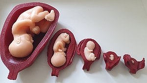 Entwicklung Embryo