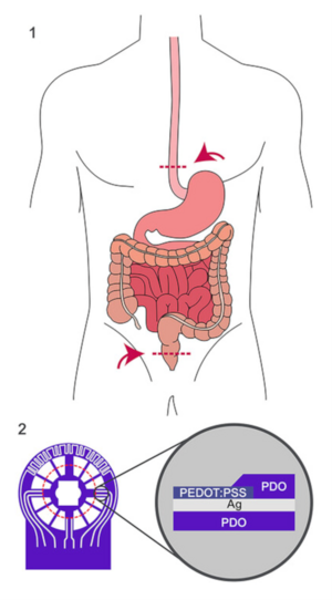 Schematische Darstellung von möglichen Positionen von Anastomosen im Dickdarm und in der Speiseröhre. 