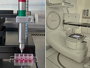 Plasma-Jet mit motorisierter Steuerung